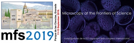 Congreso de microspia óptica y electrónica Congreso de microspia óptica y electrónica