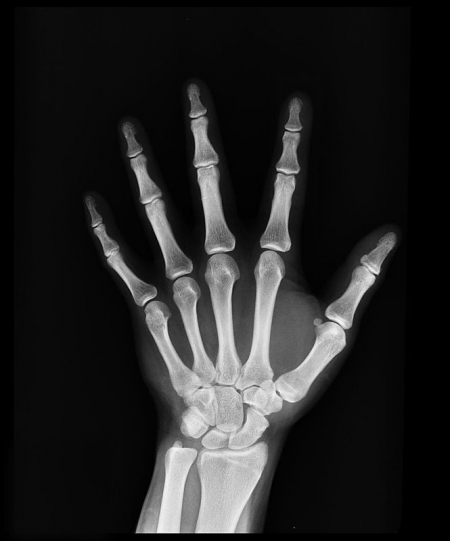 Radiografia Radiografia