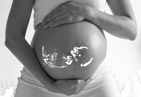 Mujer embarazada (UGR) 