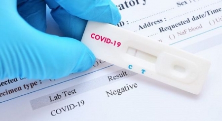 Test PCR para detectar el coronavirus (PLANTA DOCE) 