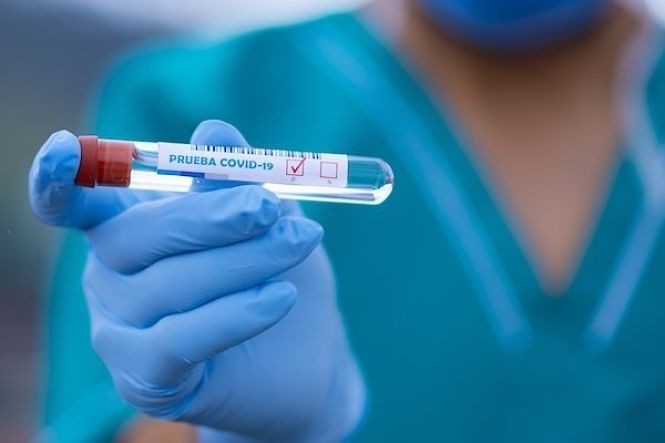 Prueba de Covid-19 (FERNANDO ZHIMINAICELA/UCC-UCM)