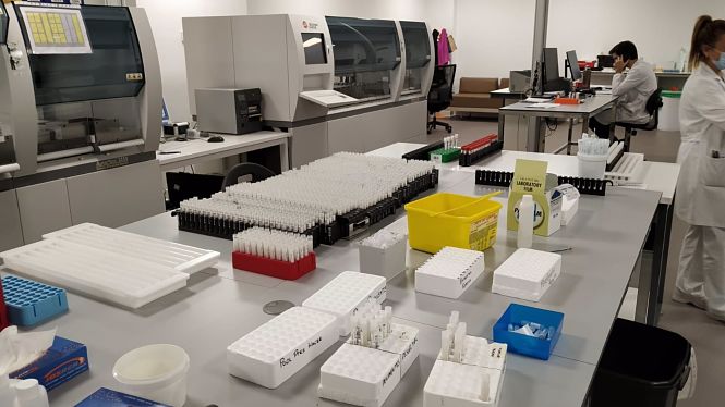 Muestras para la realización de pruebas PCR de COVID-19 (SERGAS)