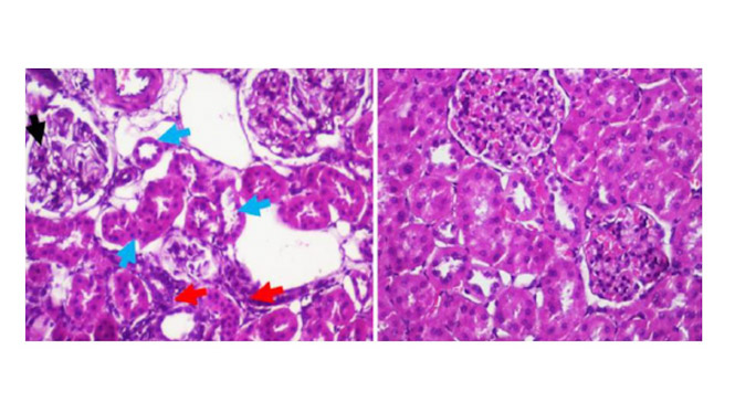 Imágenes microscópicas que muestran el aspecto anormal del riñón (UGR)
