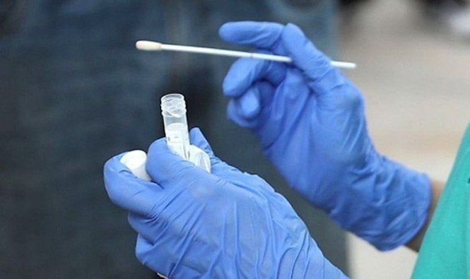 Realización de un test PCR (REDACCIÓN MÉDICA)