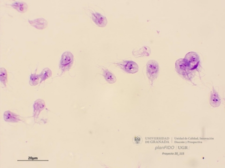 Trofozoito de Giardia lamblia (UGR) Trofozoito de Giardia lamblia (UGR)