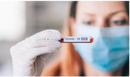 Coronavirus (FARMAINDUSTRIA) Coronavirus (FARMAINDUSTRIA)