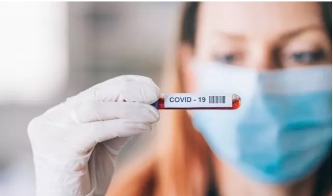 Coronavirus (FARMAINDUSTRIA)