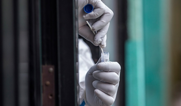 Una prueba PCR para la detección de casos de coronavirus (JUNTA ANDALUCÍA)