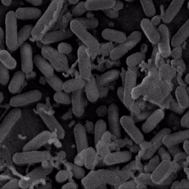 Imagen microscópica de bacterias del género Listeria (CEU UCH) 