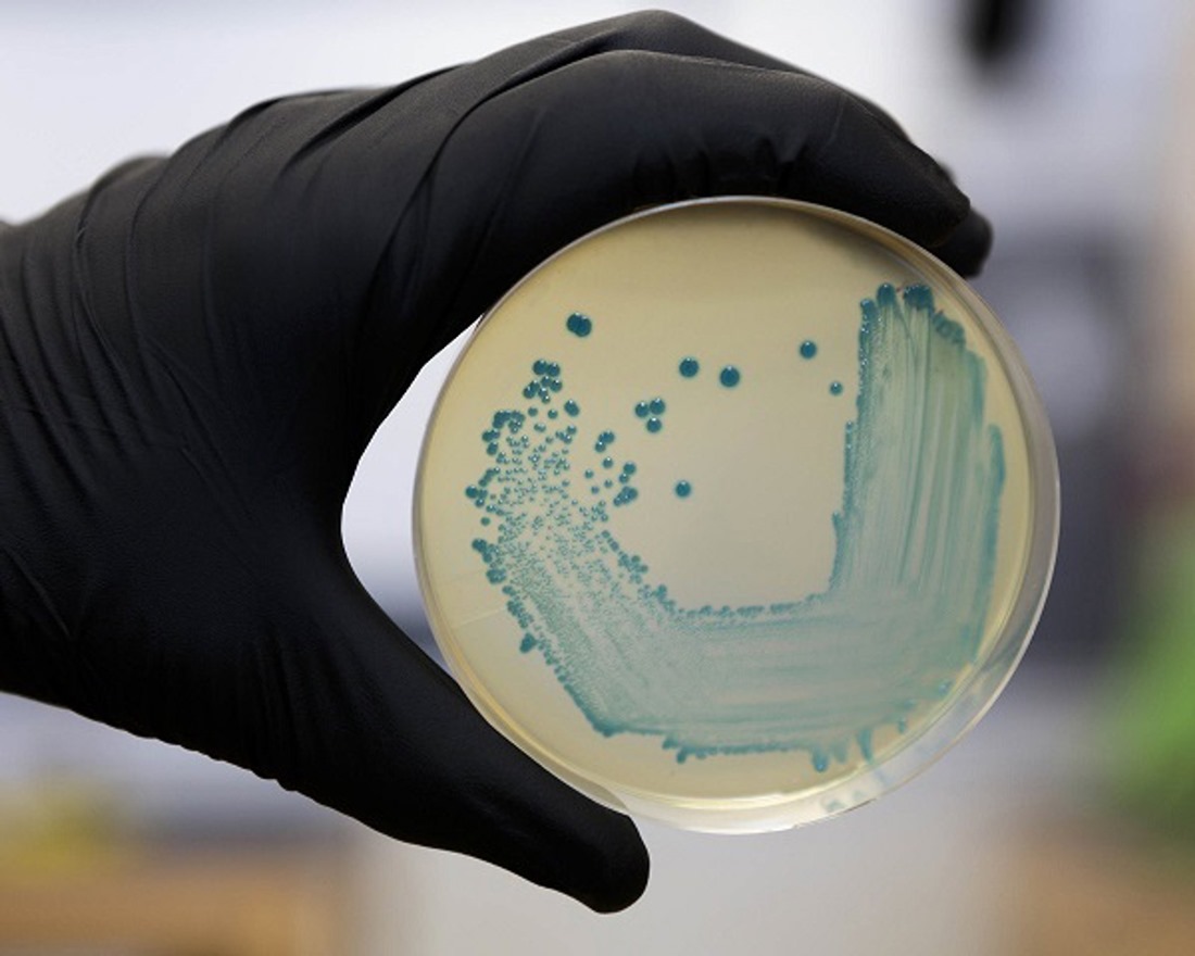 Muestra de listeria monocytogenes, en imagen de archivo (RECTORADO UNIVERSIDAD COMPLUTENSE)