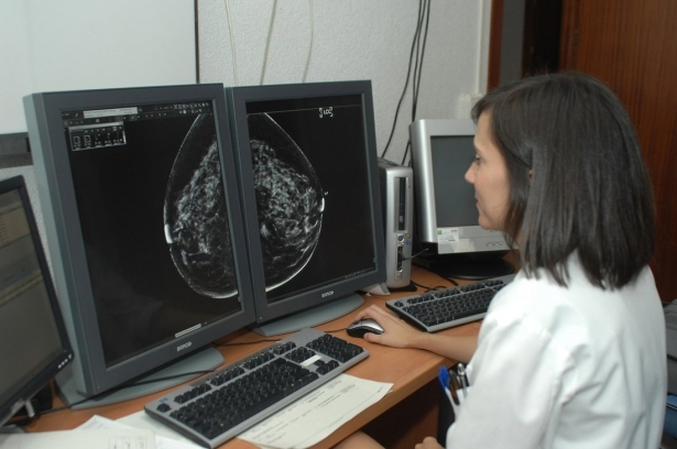 Imagen de archivo de un sistema para la detección precoz del cáncer de mama (JUNTA DE ANDALUCÍA)