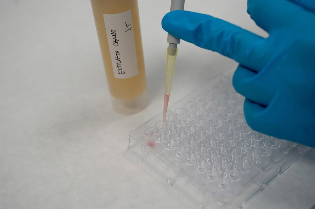 Prueba de laboratorio. Archivo (ITENE)